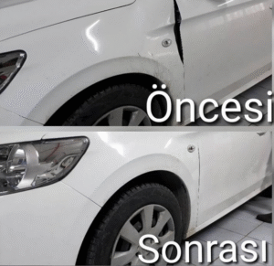 Boyasız Göçük Düzeltme Silikonu Söken Sıvı Nedir?